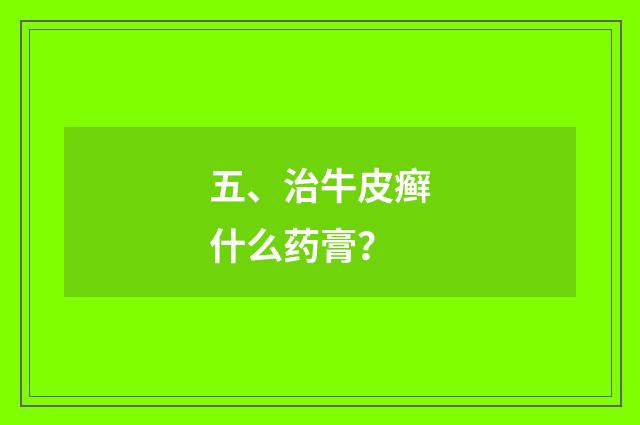 五、治牛皮癣什么药膏？
