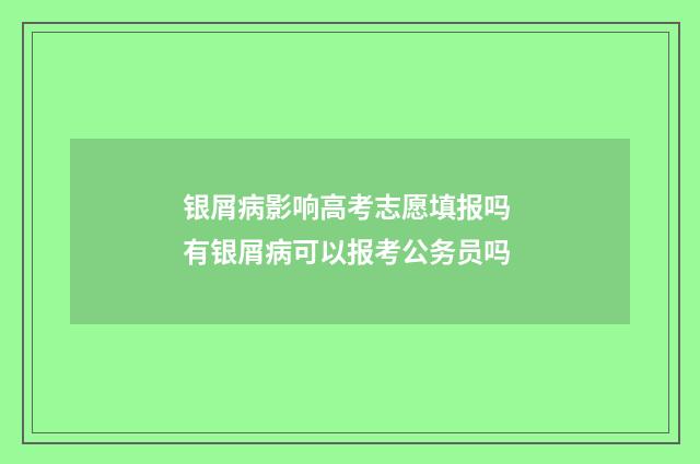 银屑病影响高考志愿填报吗 有银屑病可以报考公务员吗