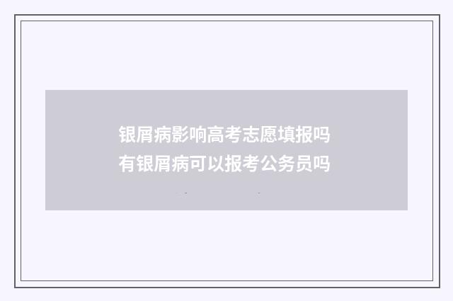 银屑病影响高考志愿填报吗 有银屑病可以报考公务员吗